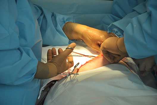 Операции на поджелудочной железе челябинск